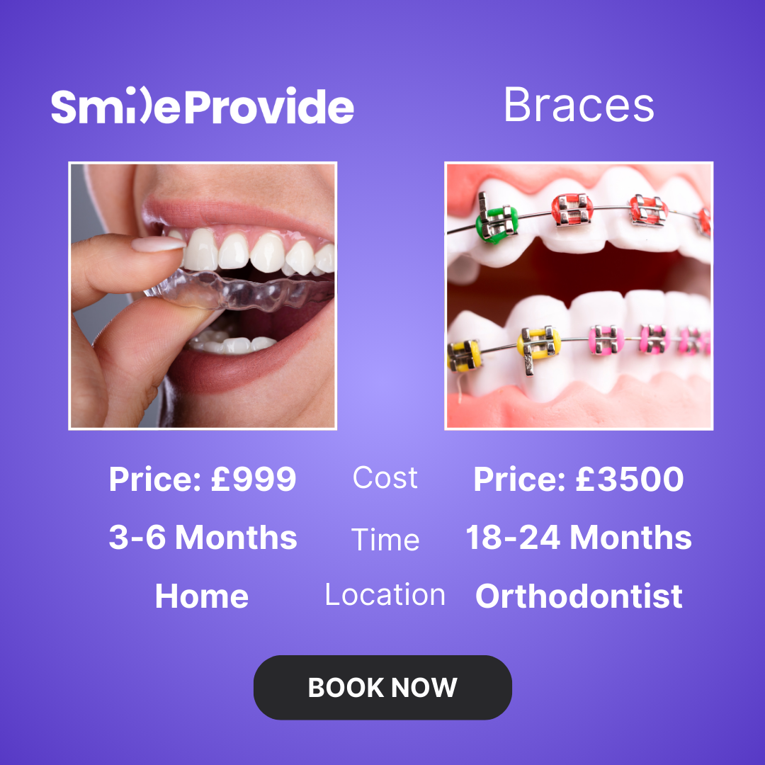 Smile Provide Facebook ad
