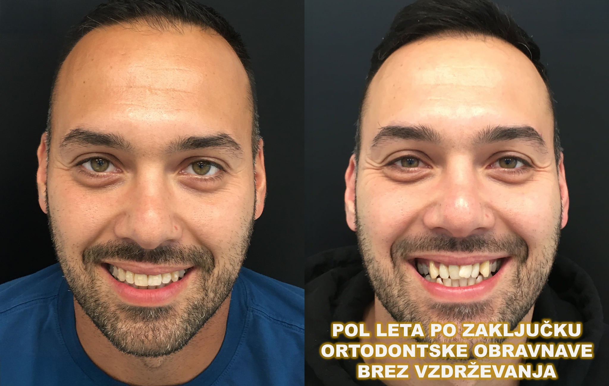 VBO - Digitalno zobozdravstvo Facebook ad