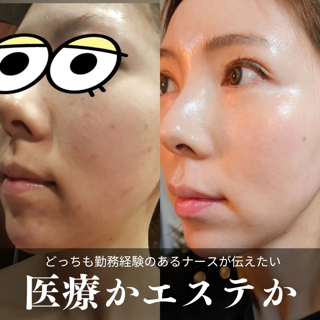 勝どき美容看護師 Facebook ad: \内面ケアを含め肌を健康的に /