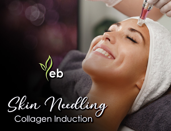 Earthen Body: Skin, Mind & Body Clinic - Maryborough/Tinana Facebook ad: SKIN NEEDLING AUTUMN SPECIAL