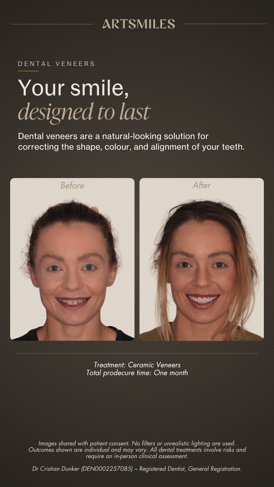 ArtSmiles Facebook ad