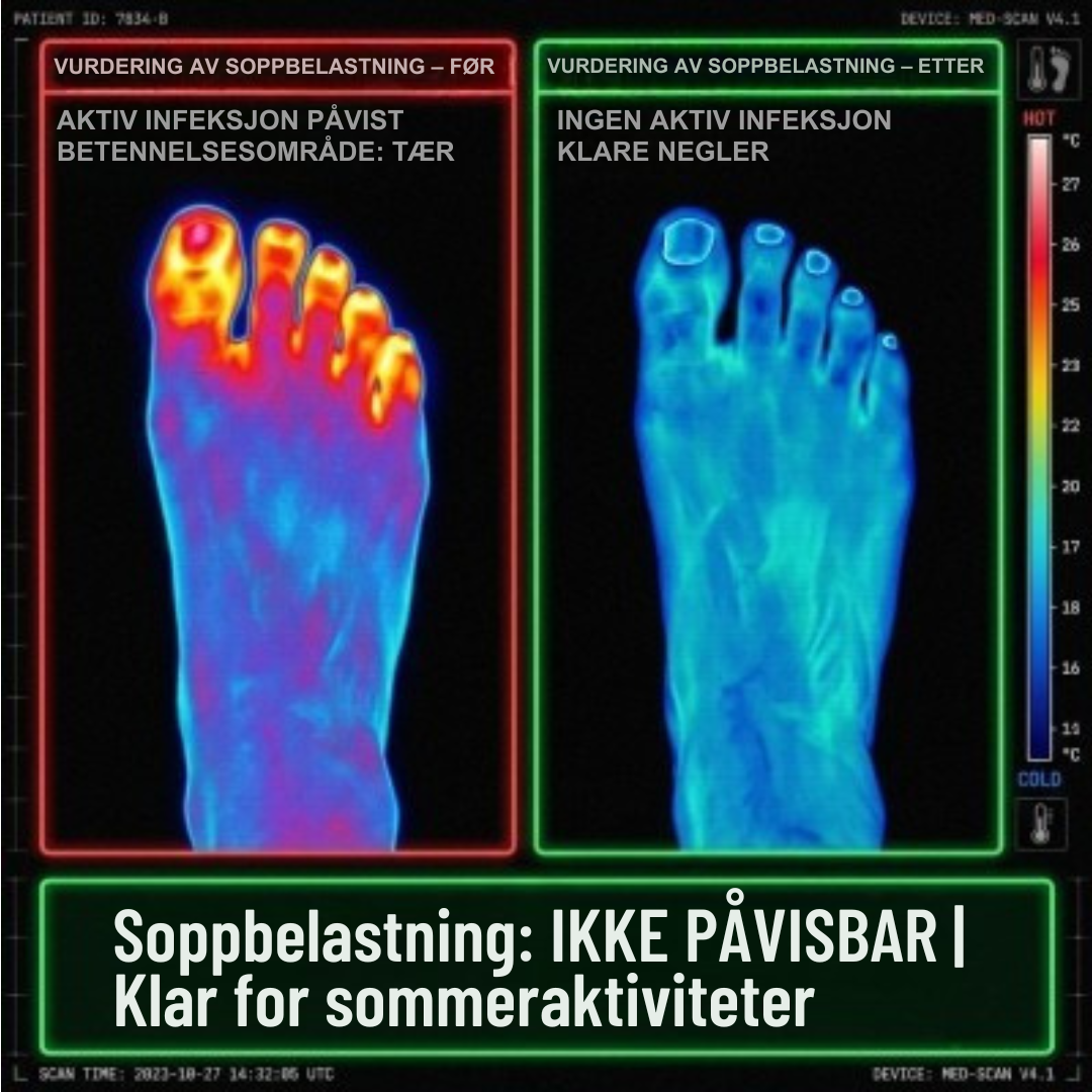 Health Essentials Daily Facebook ad: Sliter du med neglesopp? Da bør du se dette