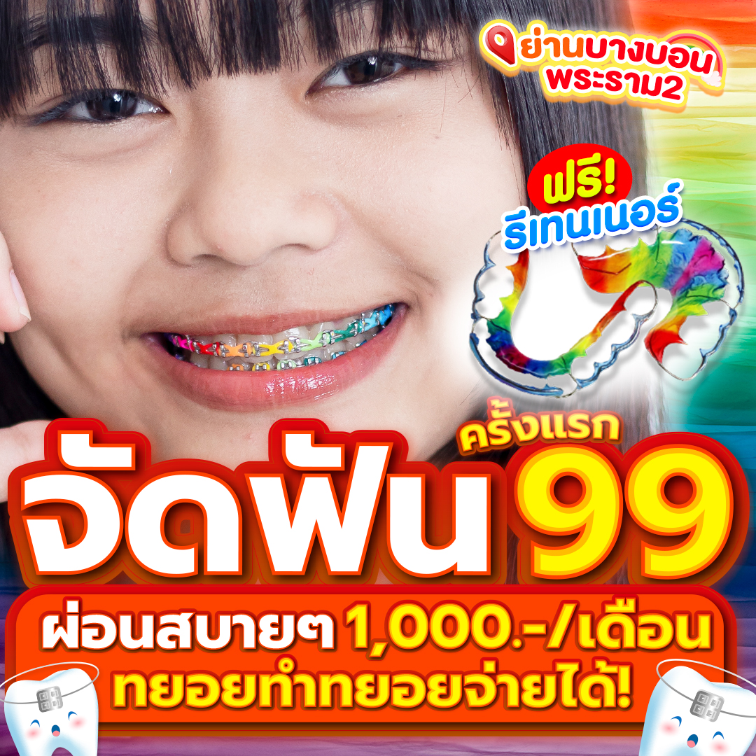 แหล่งรวมโปรโมชั่นจัดฟันดีสุด Facebook ad