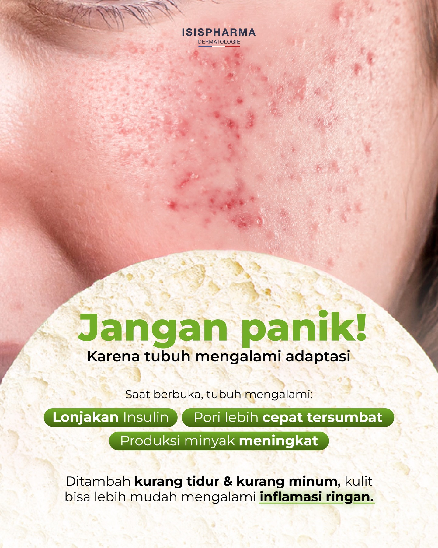 Isispharma Indonesia Facebook ad: Niatnya berbuka dengan yang manis malah jerawatan