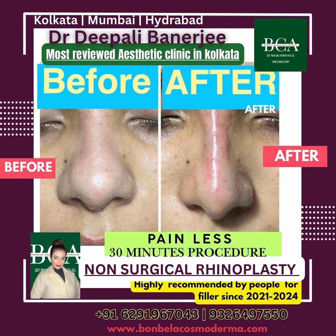 bonbela_cosmoderma_asthetic Facebook ad: Chat in Messenger