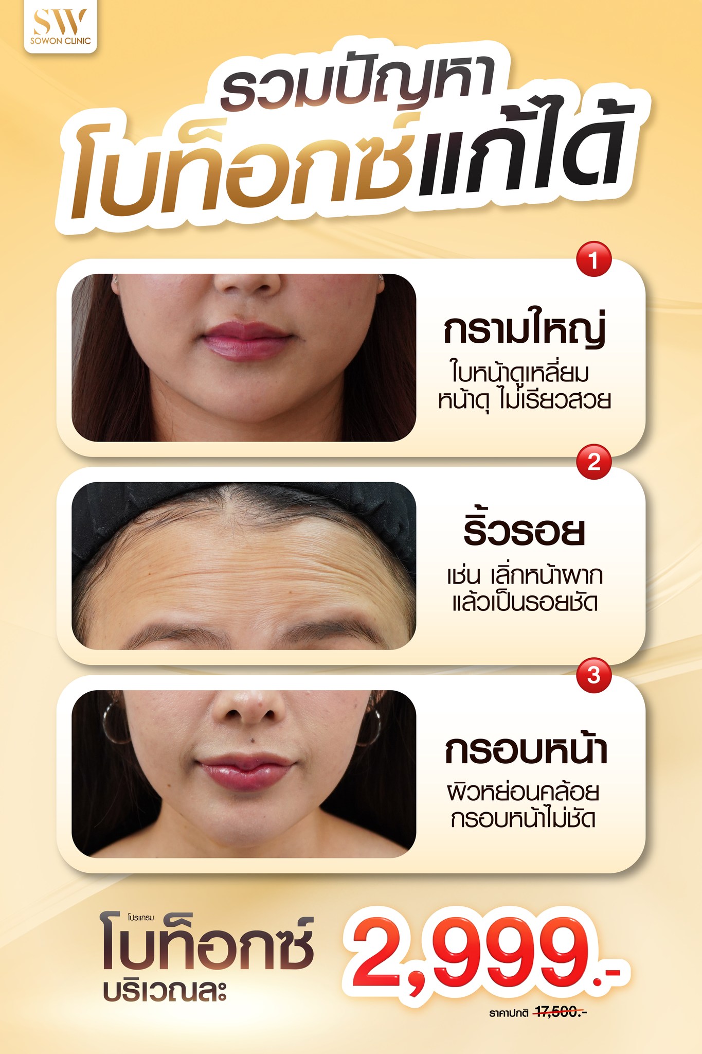Sowon clinic Botox Filler HIFU ร้อยไหม โบท็อกซ์ ฟิลเลอร์ ปรับรูปหน้า Facebook ad