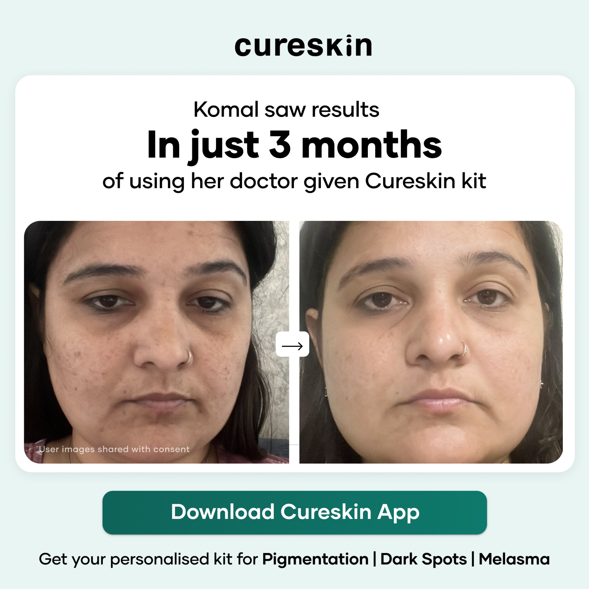 Cureskin Facebook ad