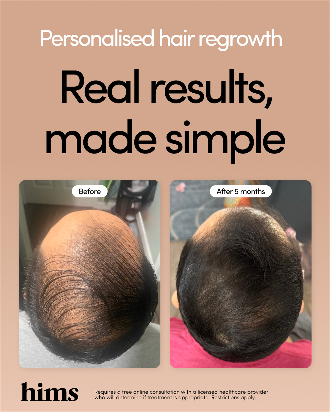 hims Facebook ad