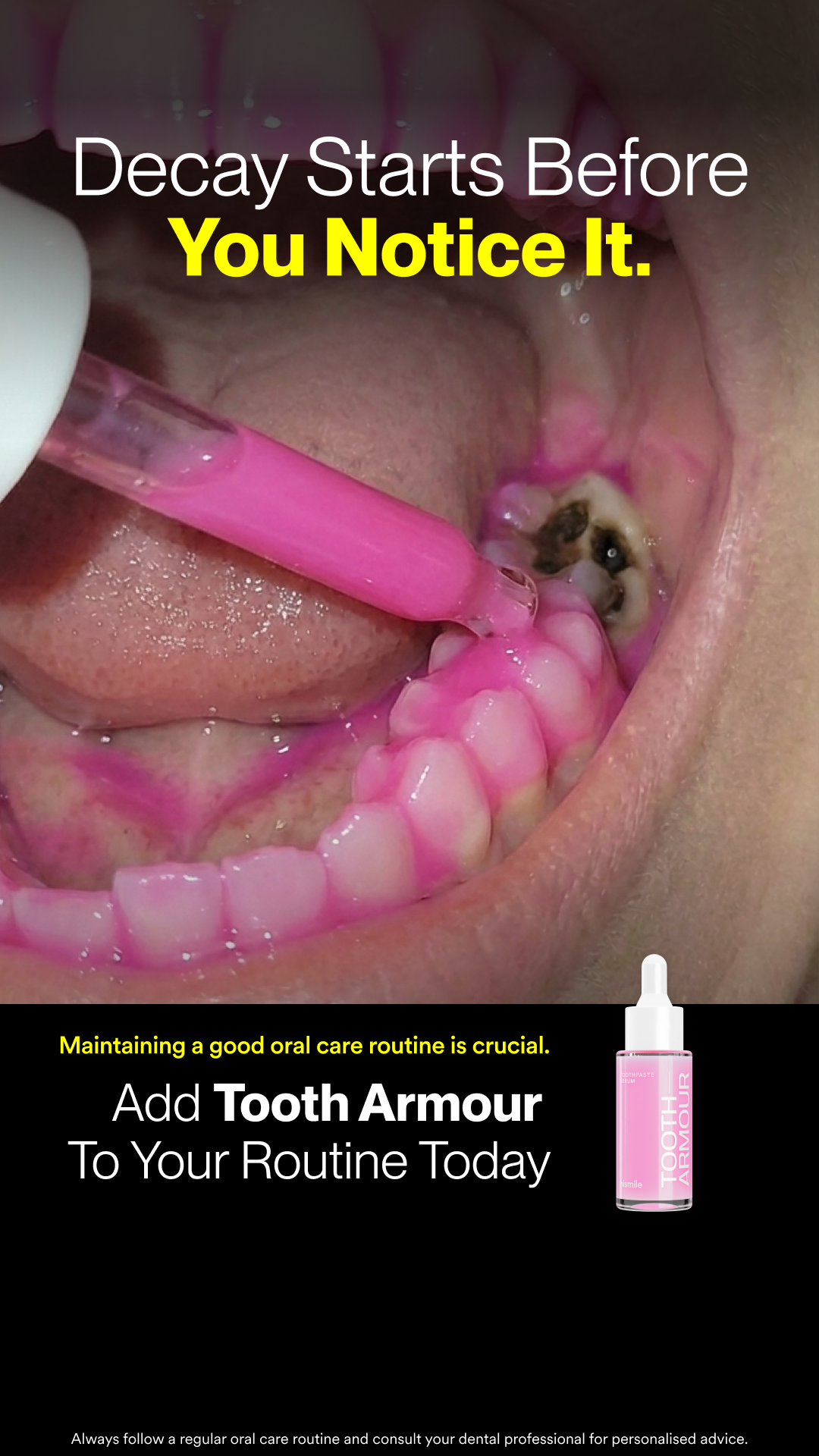 Hismile Facebook ad