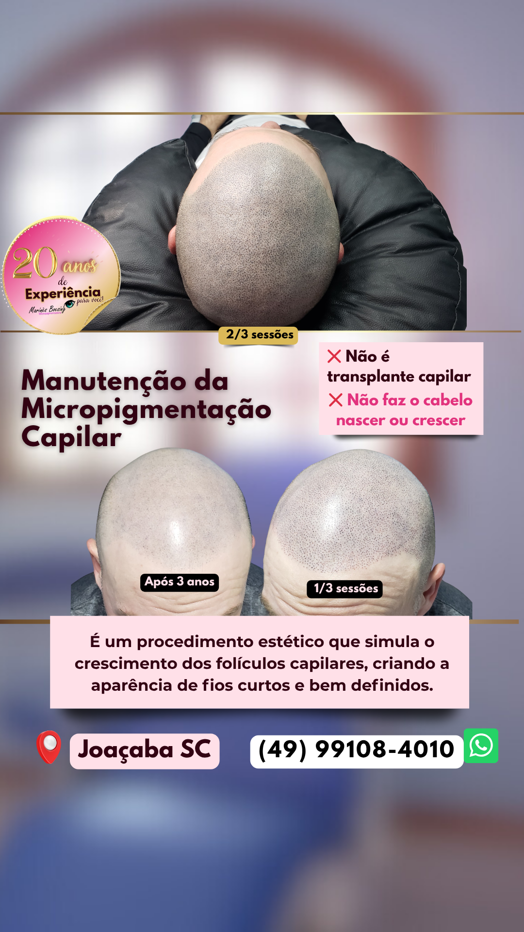 Marinês Boesing Micropigmentação Facebook ad