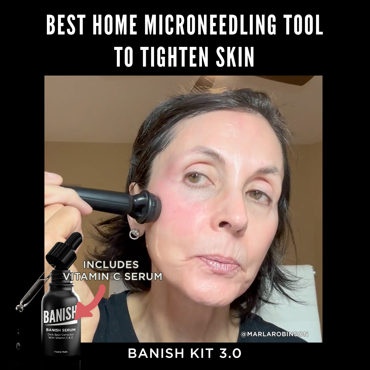 Banish Acne Scars Facebook ad
