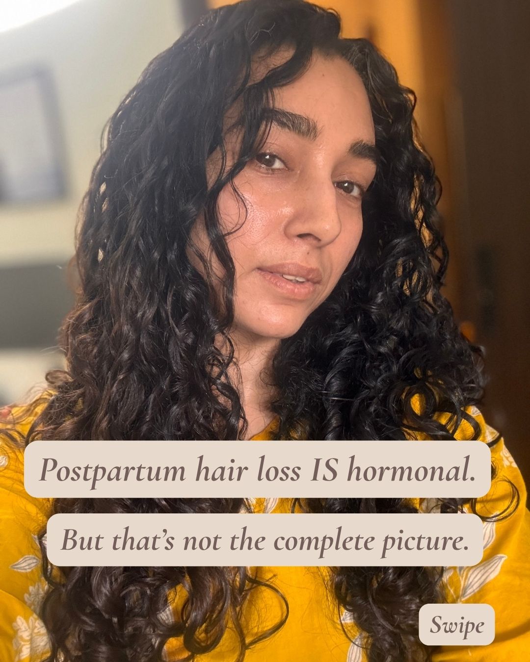 Stronger WIth Pooja Facebook ad: Postpartum hair loss is hormonal, but being told…