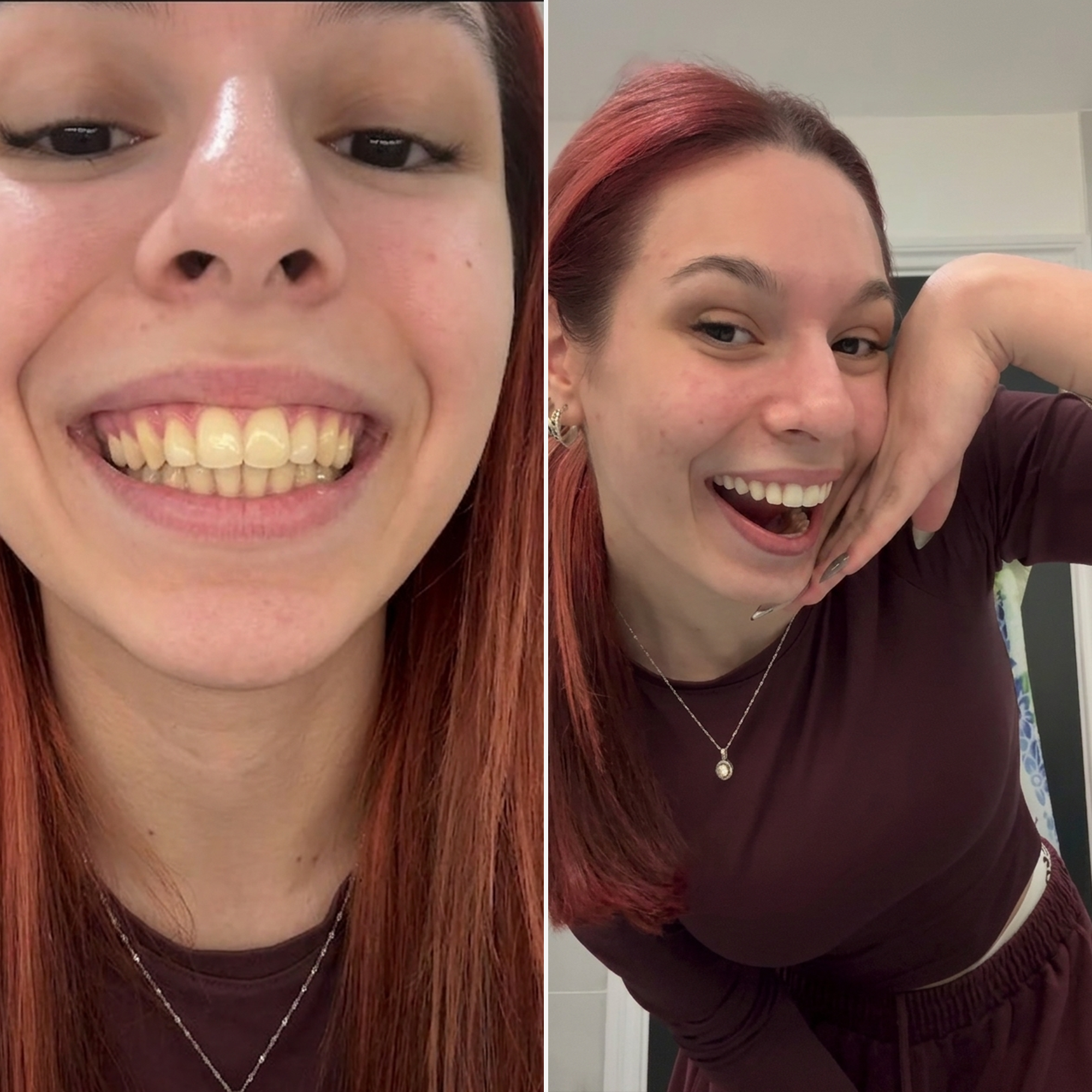 Modern Wellness Journal Facebook ad: Whiten Teeth Without Damage in 7 Days