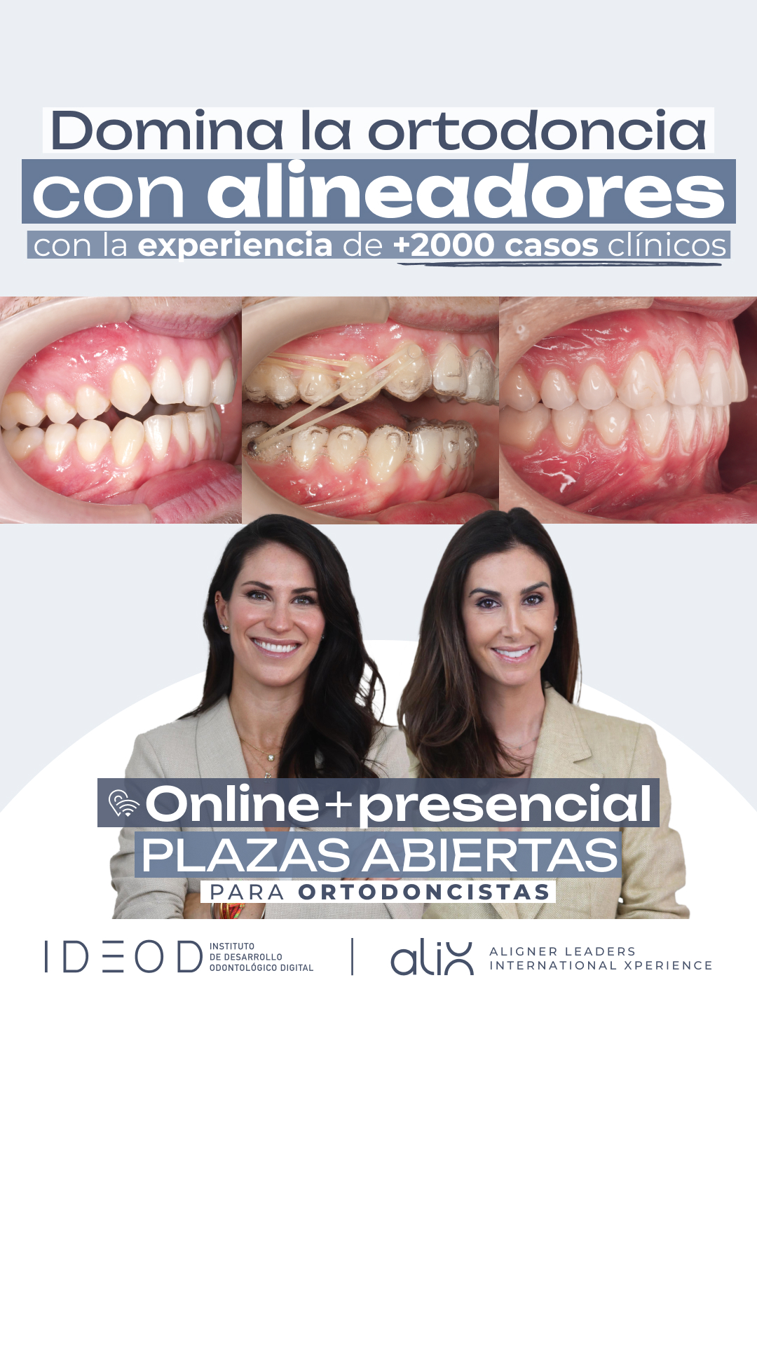 Instituto IDEOD Facebook ad: Domina los alineadores con +2.000 casos de experiencia