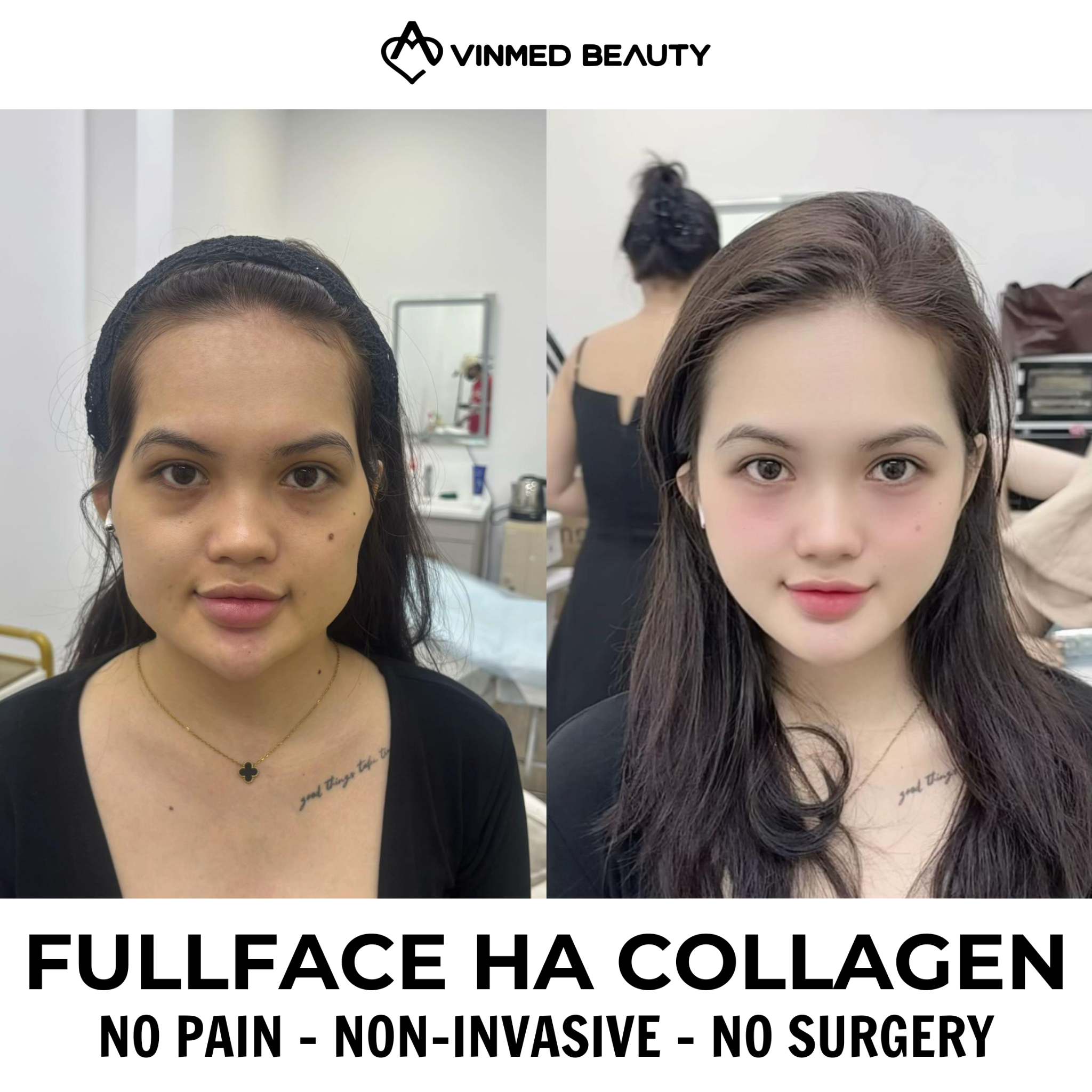 Vinmed Beauty - No. 1 Dermatology salon in Dubai Facebook ad