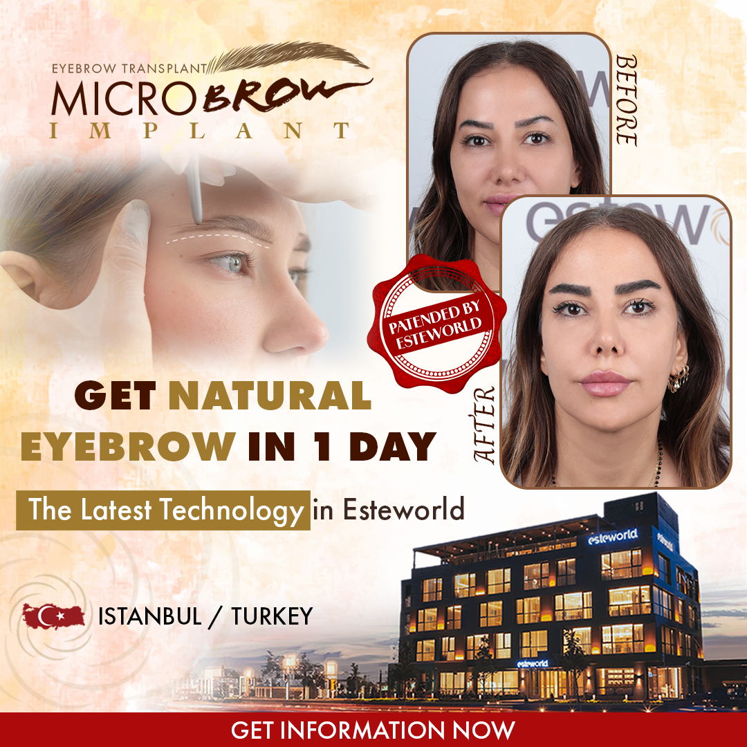 Esteworld.International Facebook ad
