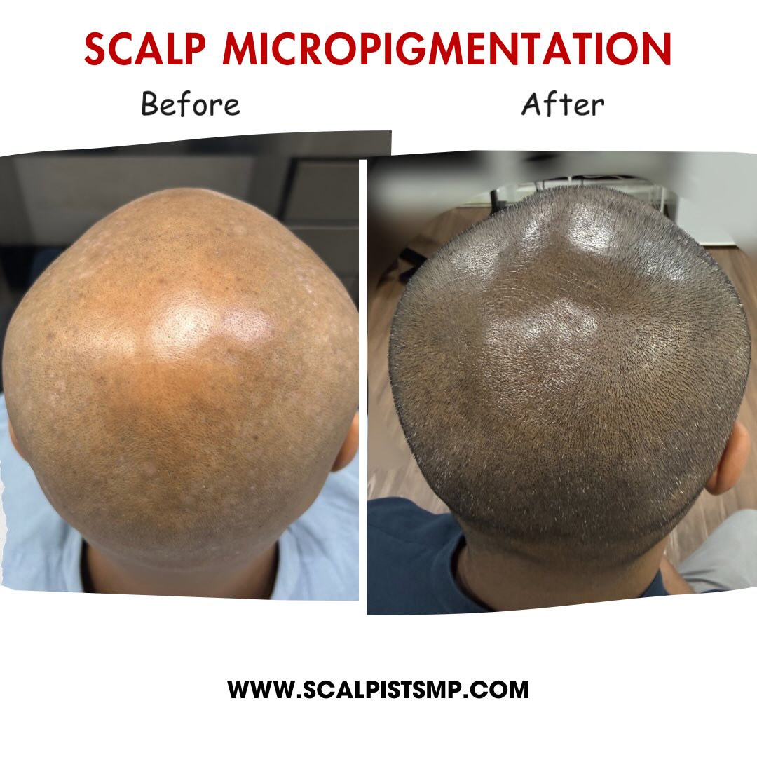 Scalpist.Smp Facebook ad