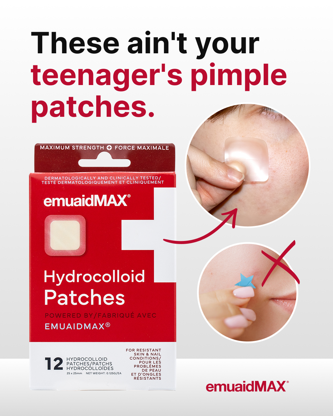 Emuaid Facebook ad