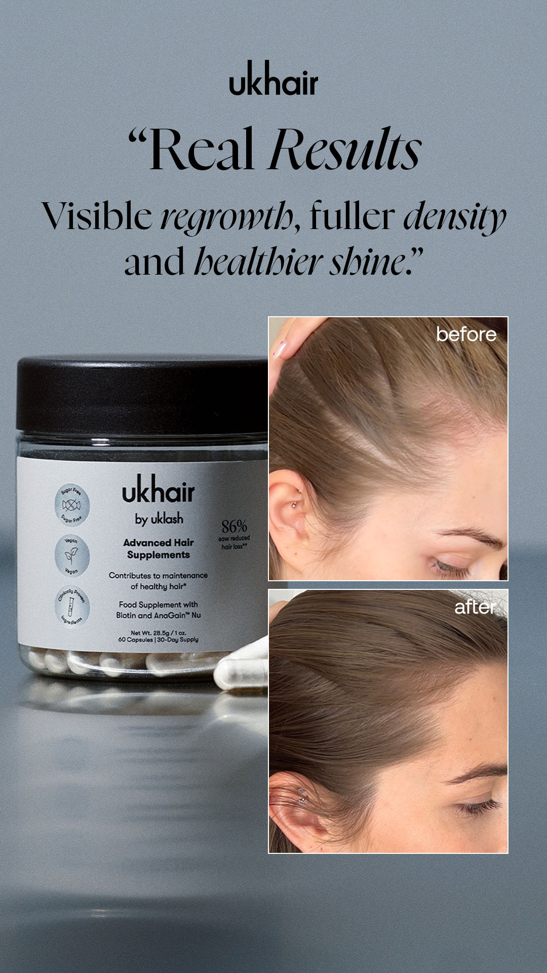 Uklash Facebook ad: Daily hair nutrition