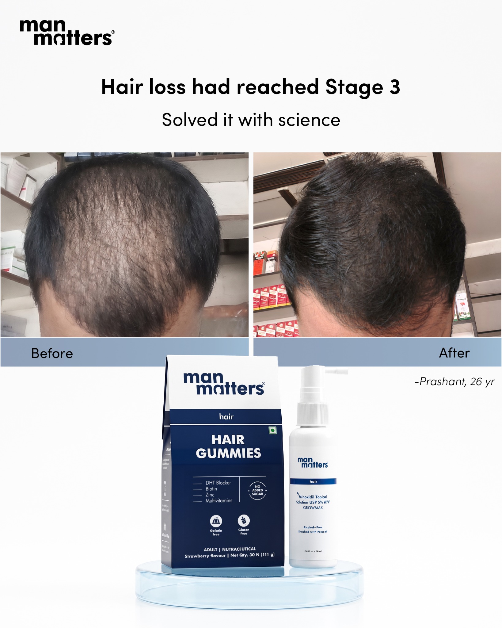 manmattershairwarriors Facebook ad