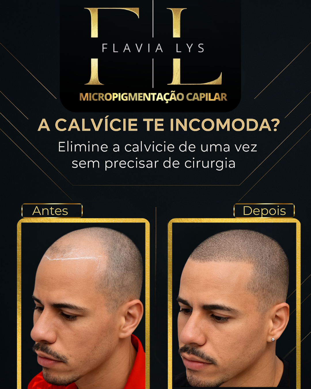 Flavia Lys Micropigmentaçao Facebook ad