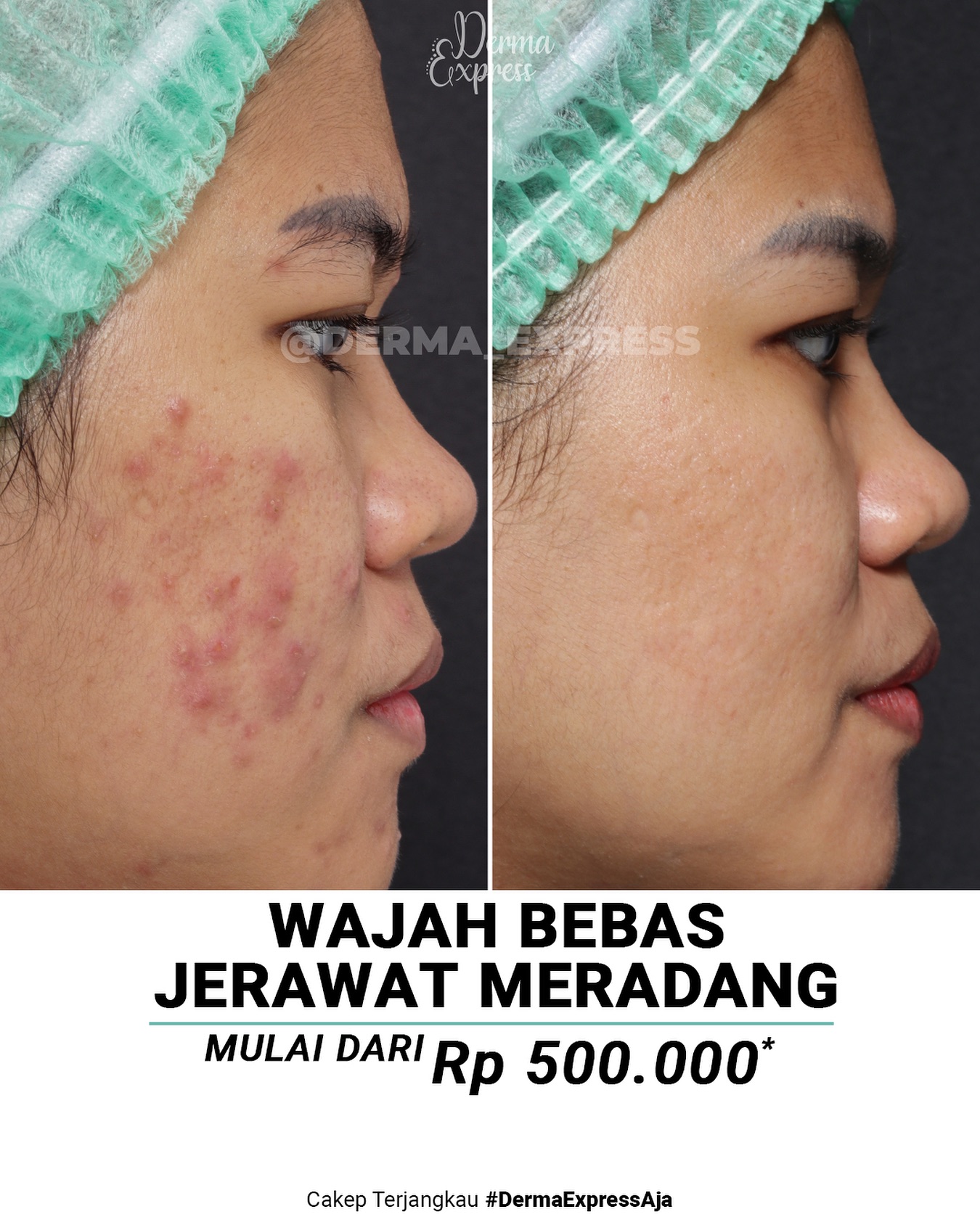 derma_express Facebook ad