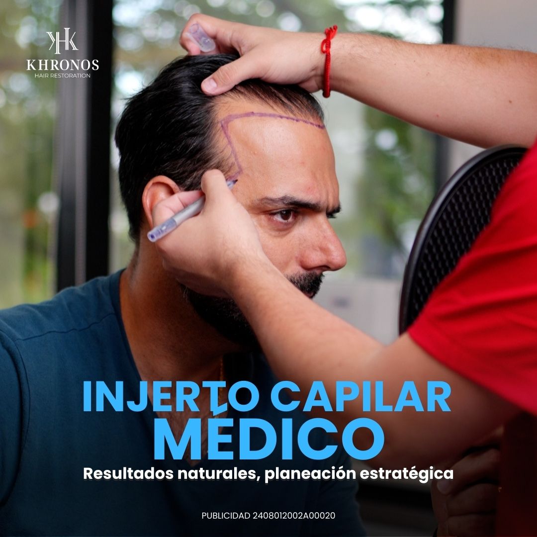 Khronos Hair Restoration Facebook ad from Feb 28, 2026