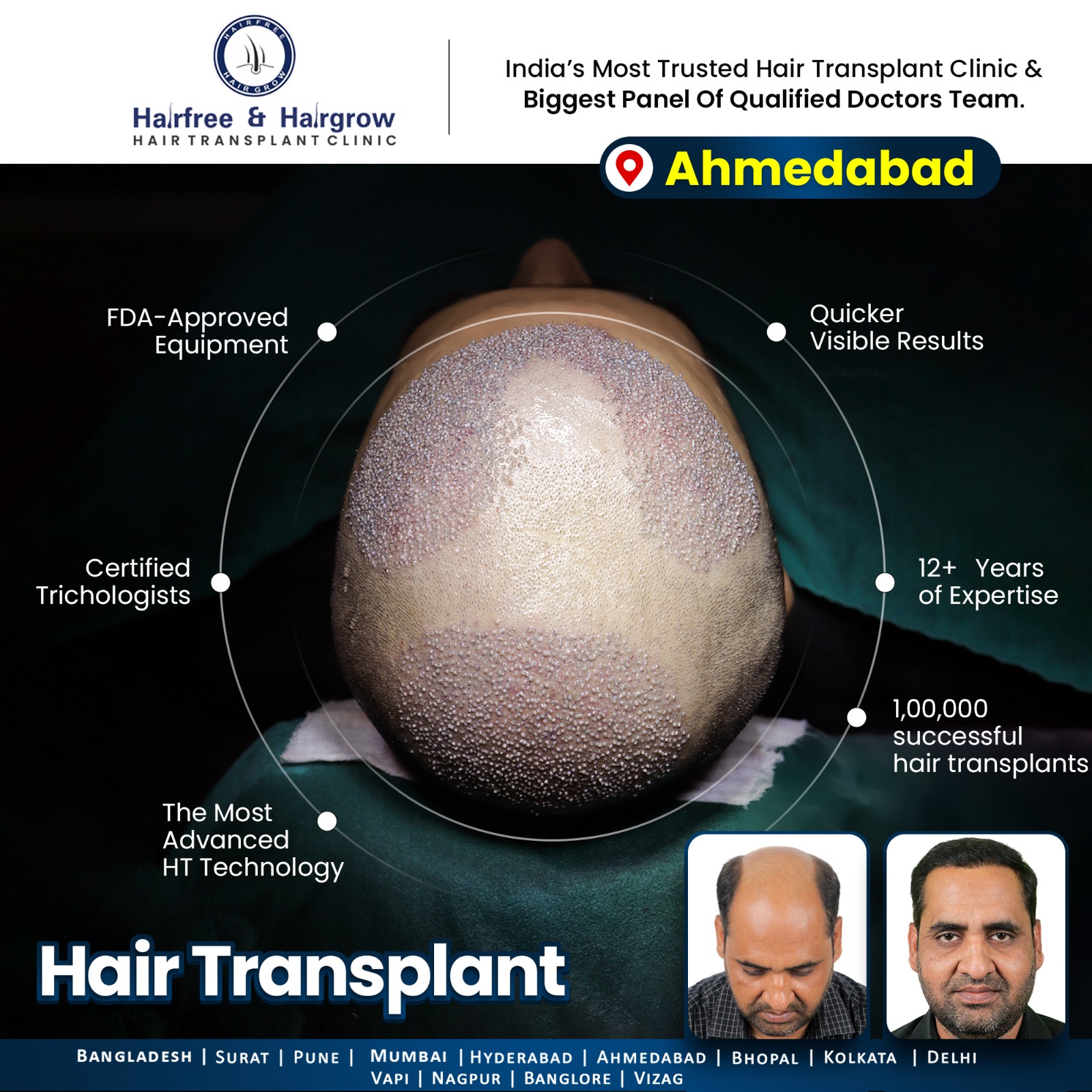 Hairfree Hairgrow Clinic Facebook ad