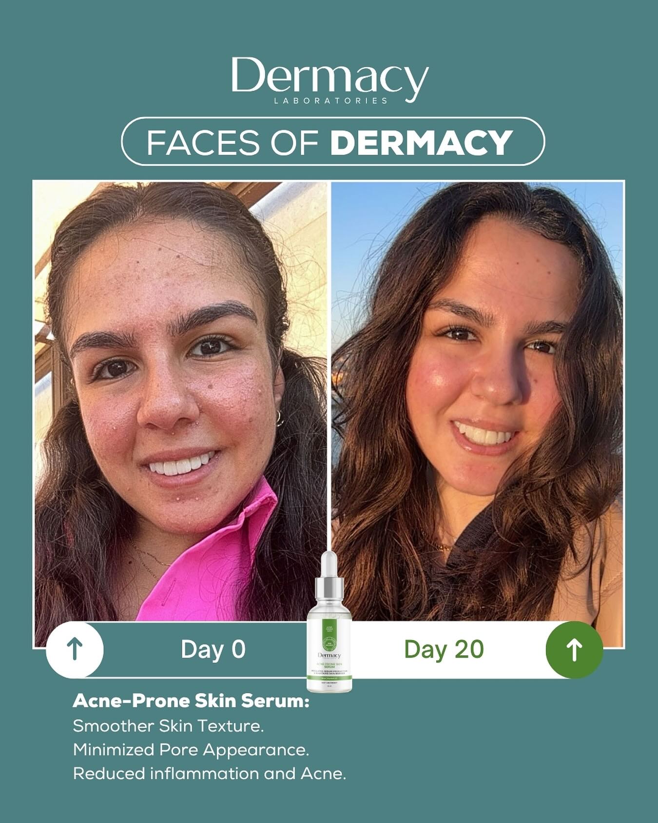 Dermacy Labs Facebook ad: Real Skin. Real Stories.