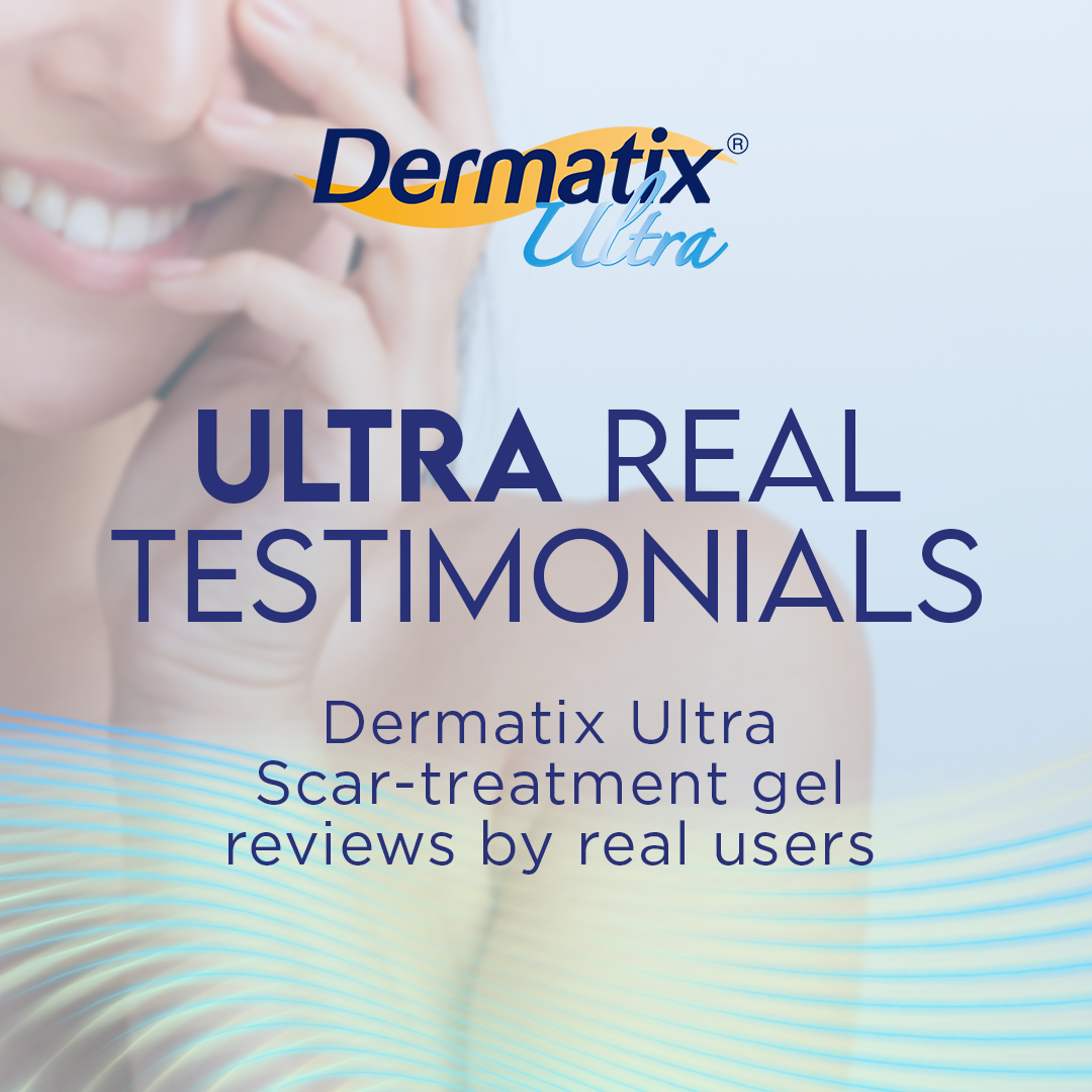 Dermatix Ultra Philippines Facebook ad: Peklat-conscious dati? Confident ngayon!