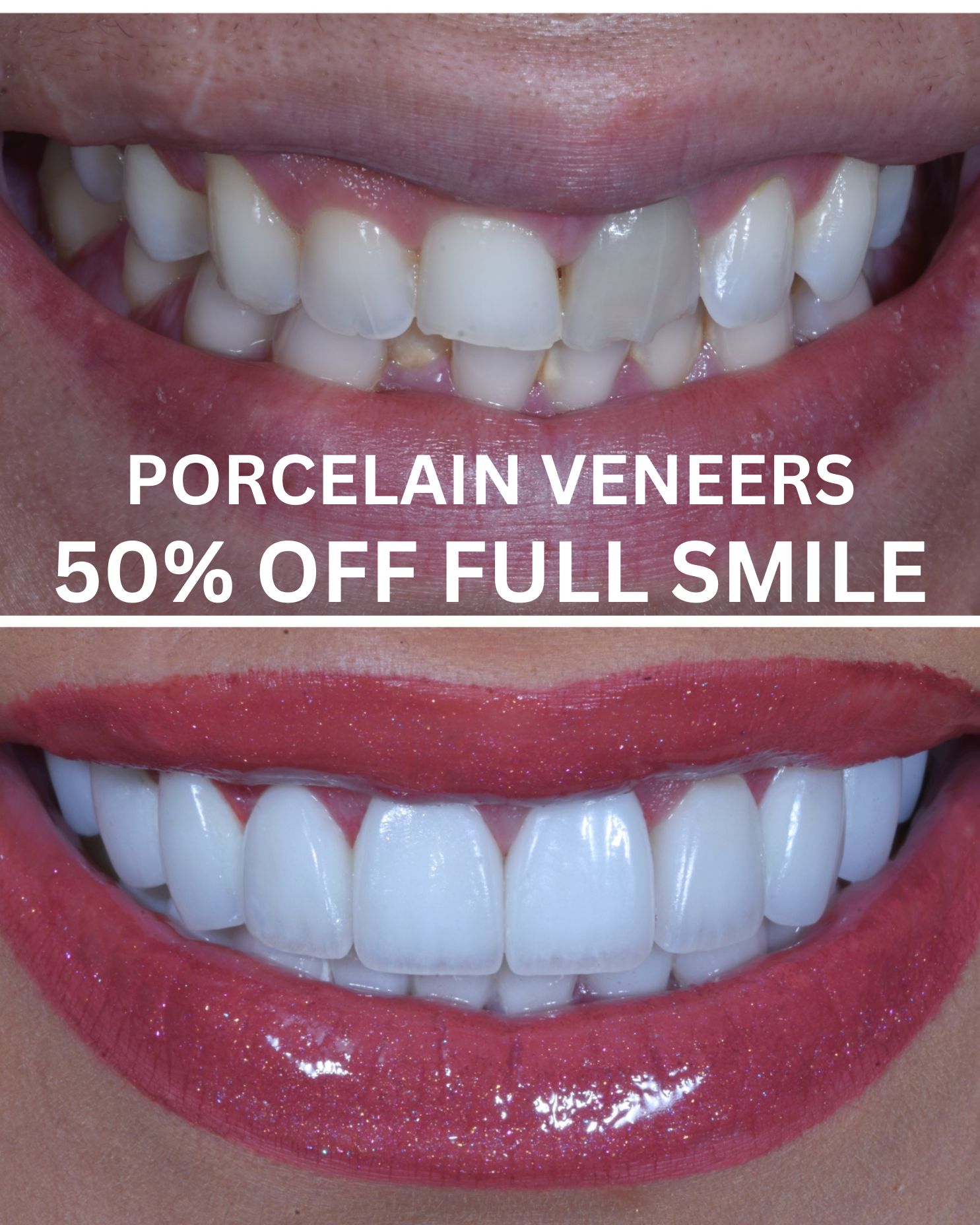 L.A. Smile Specialists Facebook ad from Aug 16, 2026