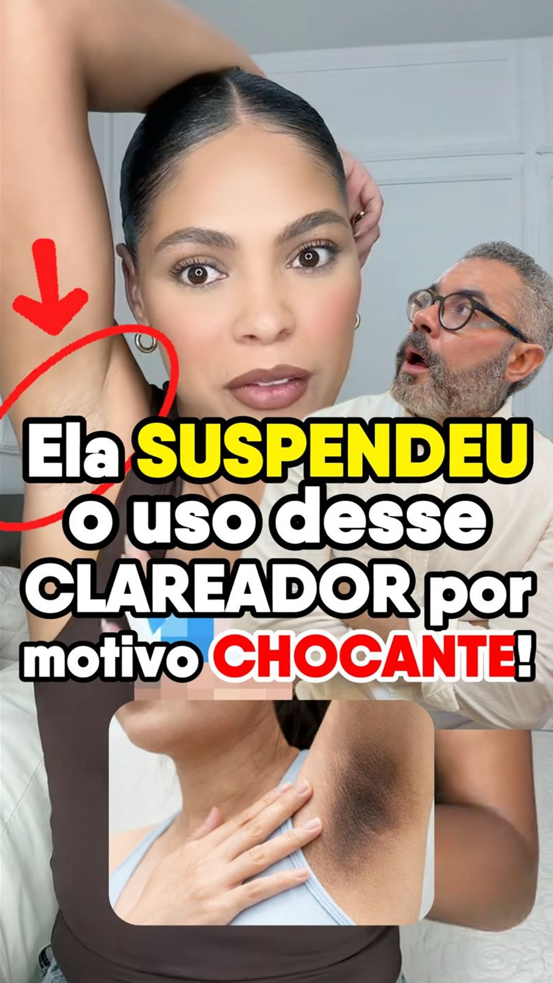 Cicatribem Facebook ad: AS AXILAS CLAREARAM tanto que ela Precisou PARAR…