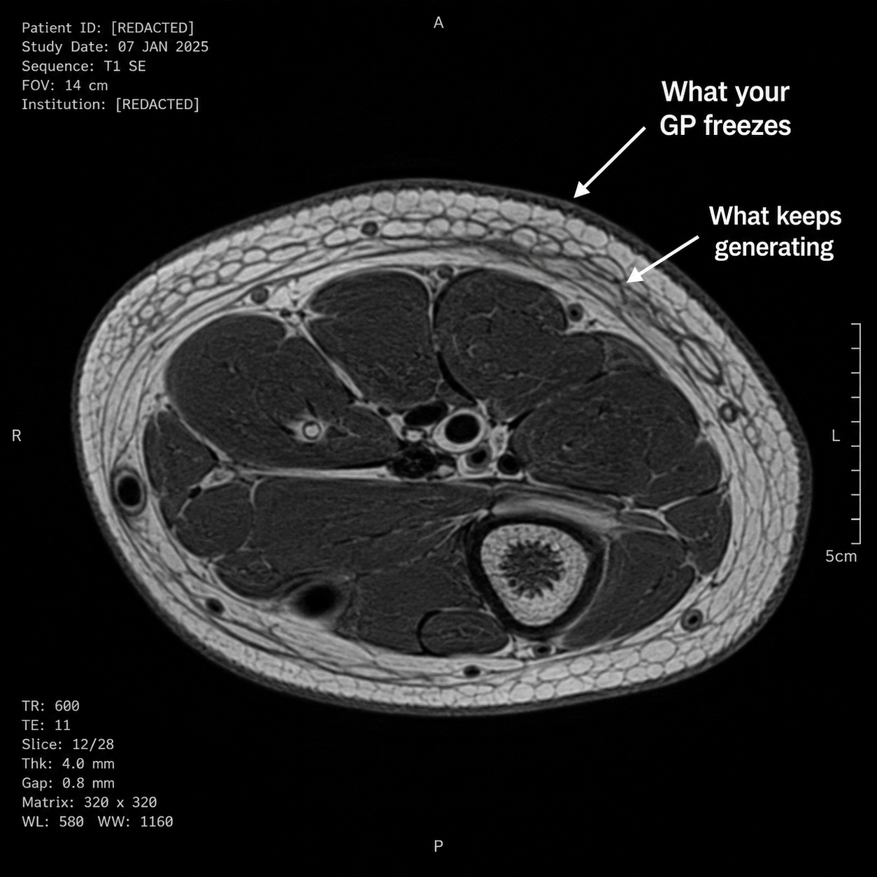 Actinic Keratosis Recovery Facebook ad: Your GP Treats the Arrow on Top. The One Below Is Why It…