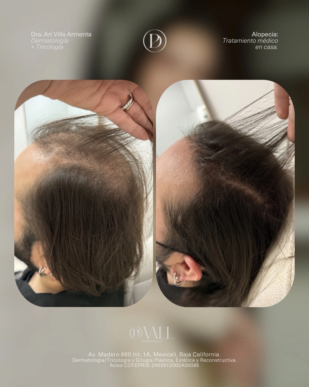 valldermaplastic Facebook ad