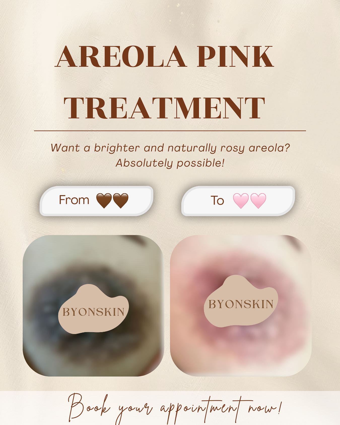 Byonskinpik Facebook ad