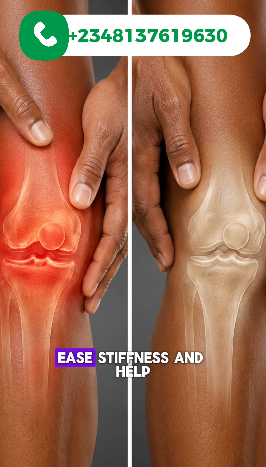Nature Solution Facebook ad: Tired of Joint and Bone Pain?