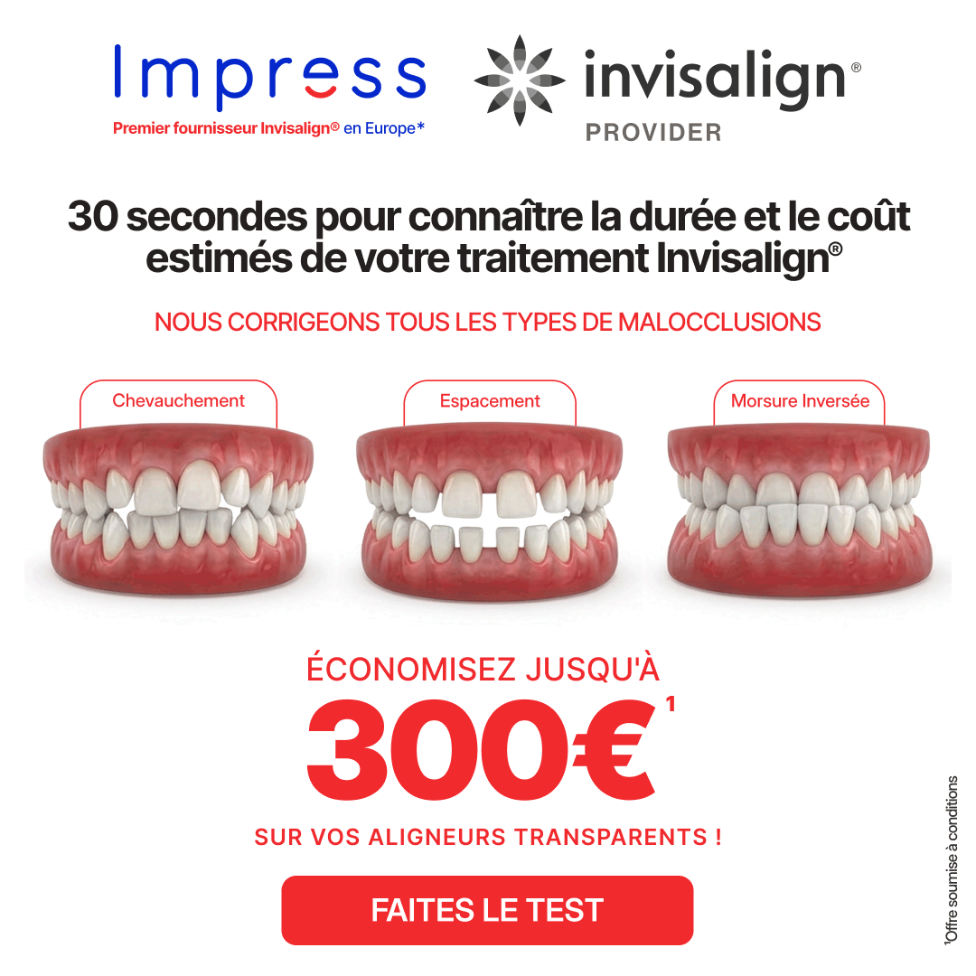 Impress_fr Facebook ad from Jun 3, 2026