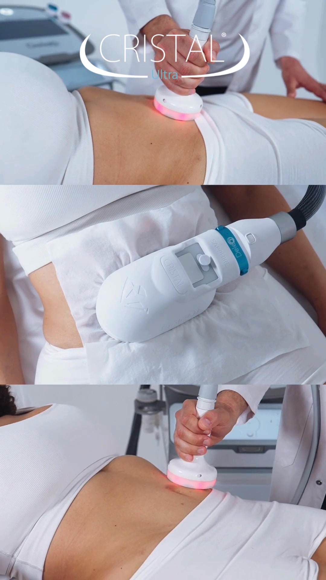 Deleo Facebook ad: La nouvelle génération du body contouring