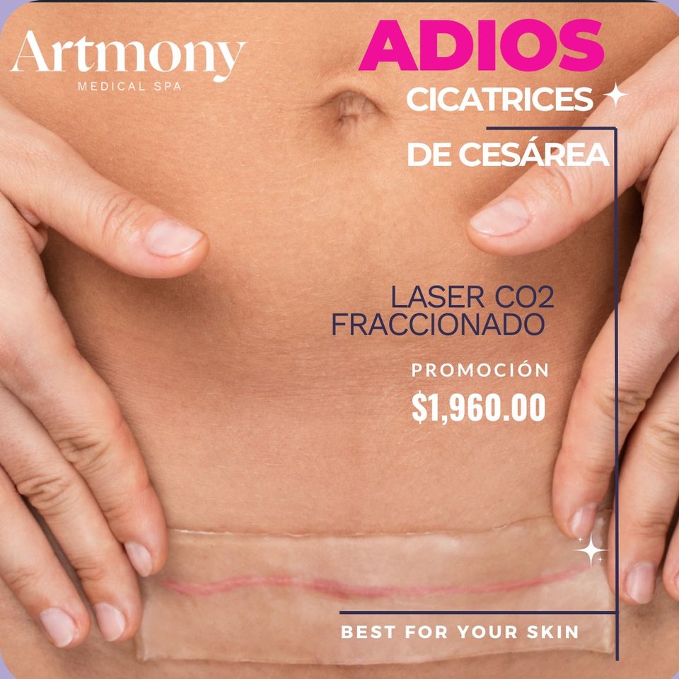 Artmony Medical Spa PDC Facebook ad