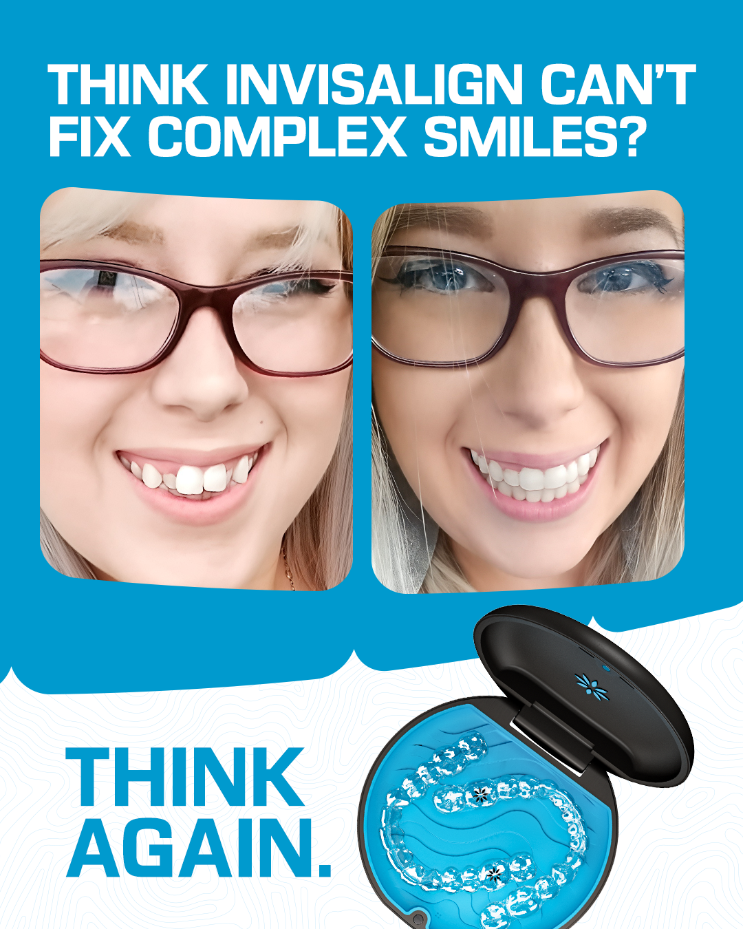Invisalign Facebook ad