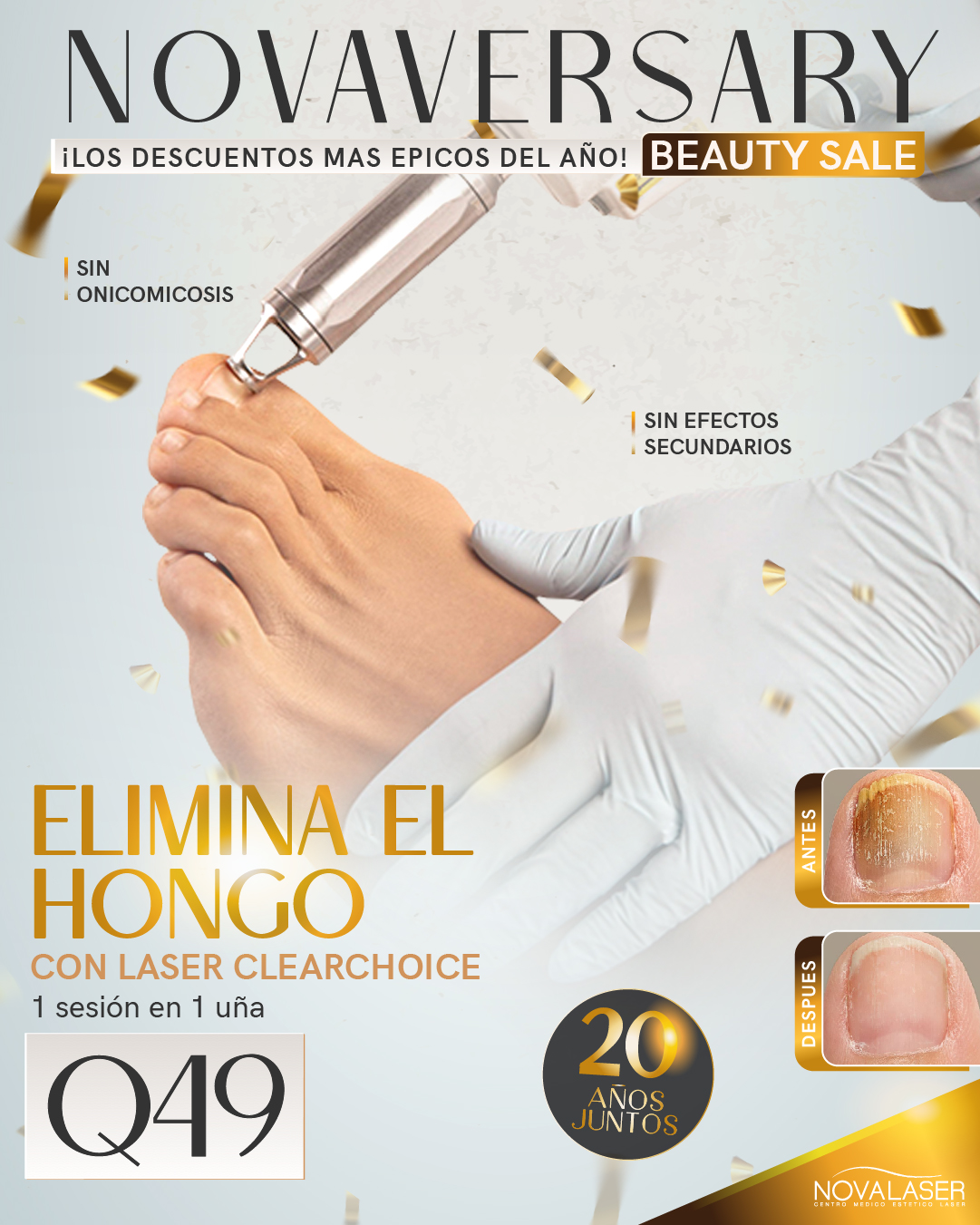 Novalaser Miraflores Facebook ad