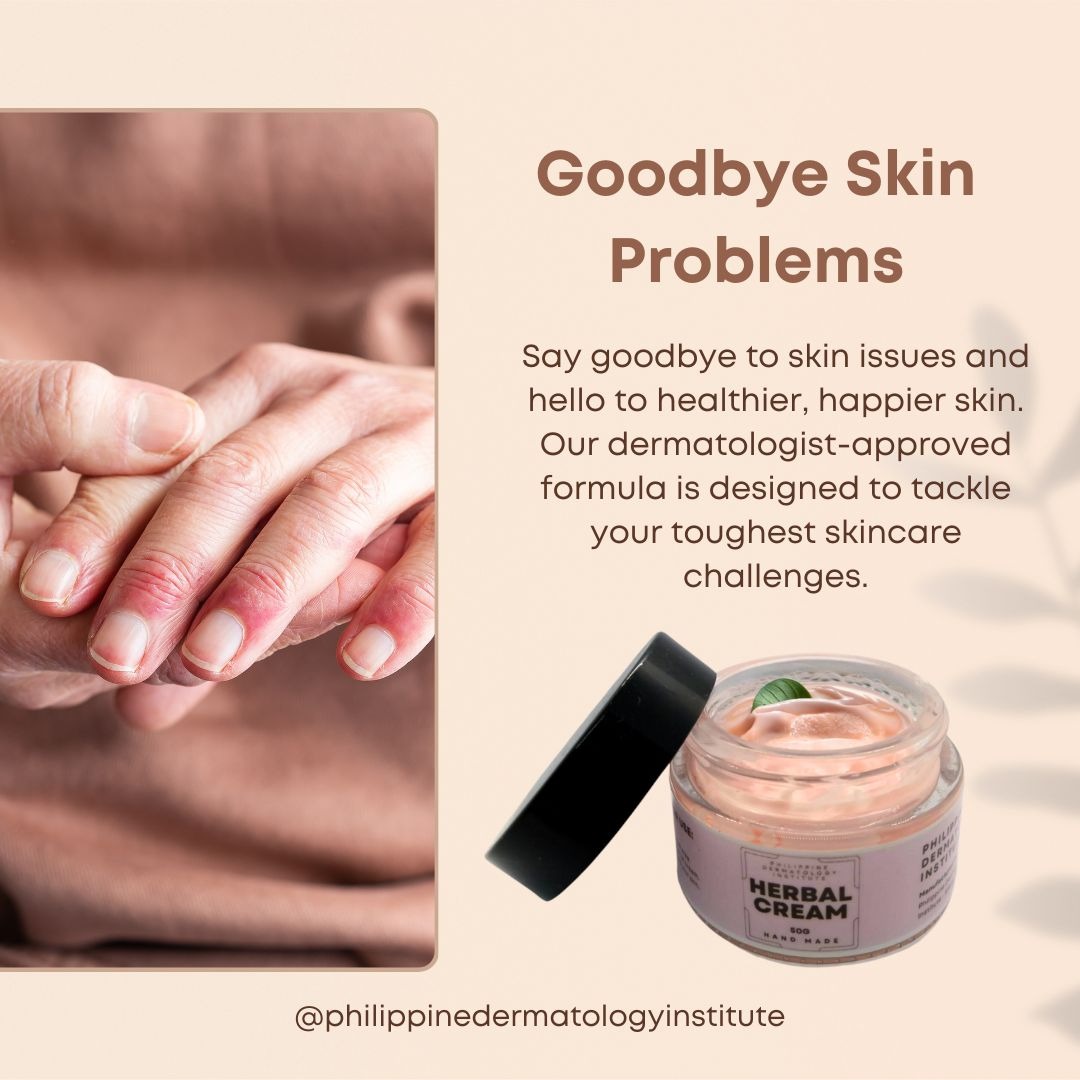 Philippines Dermatology Institute Facebook ad