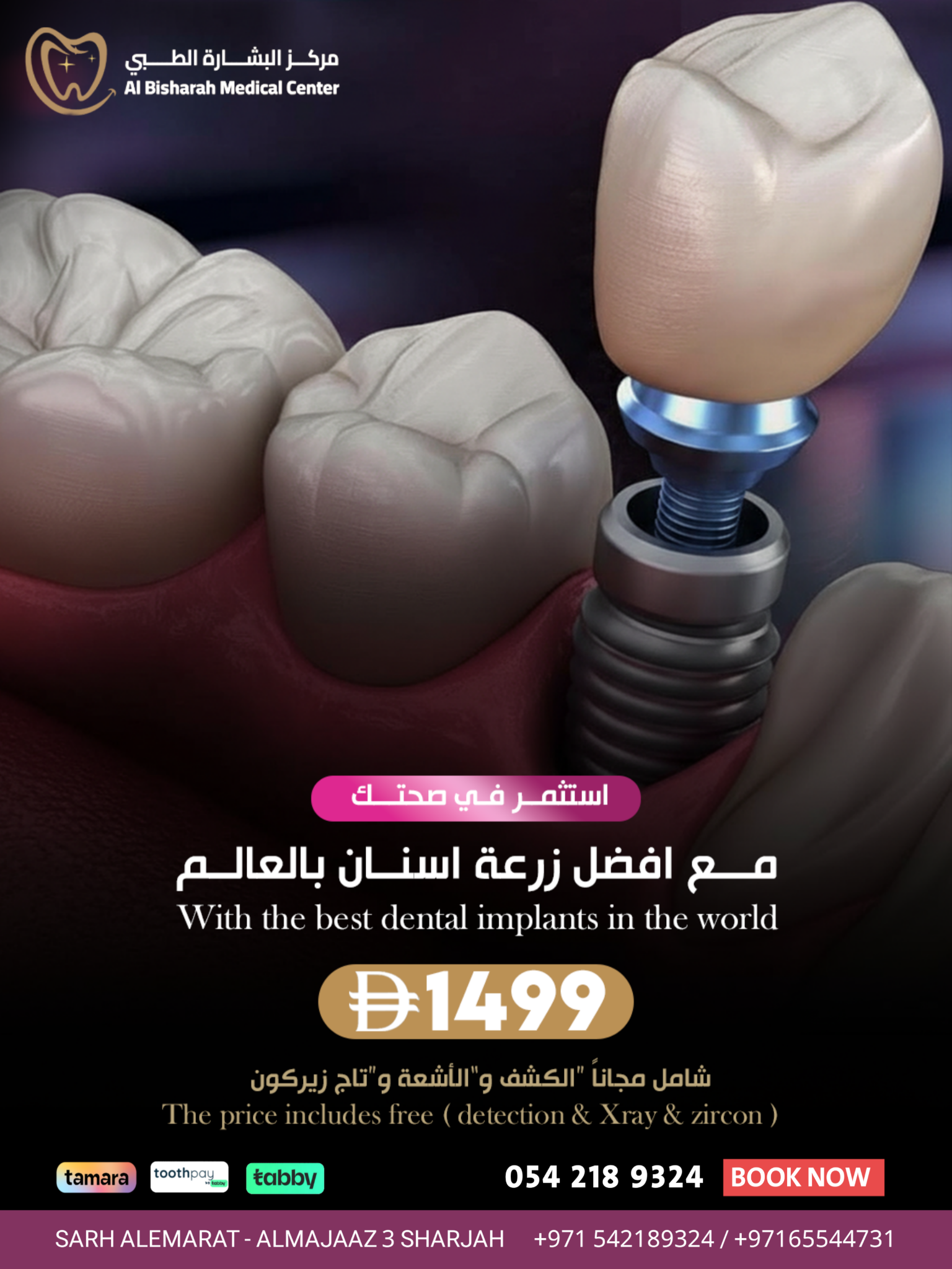 مركز البشارة الطبي Facebook ad: زراعة الاسنان الفورية
