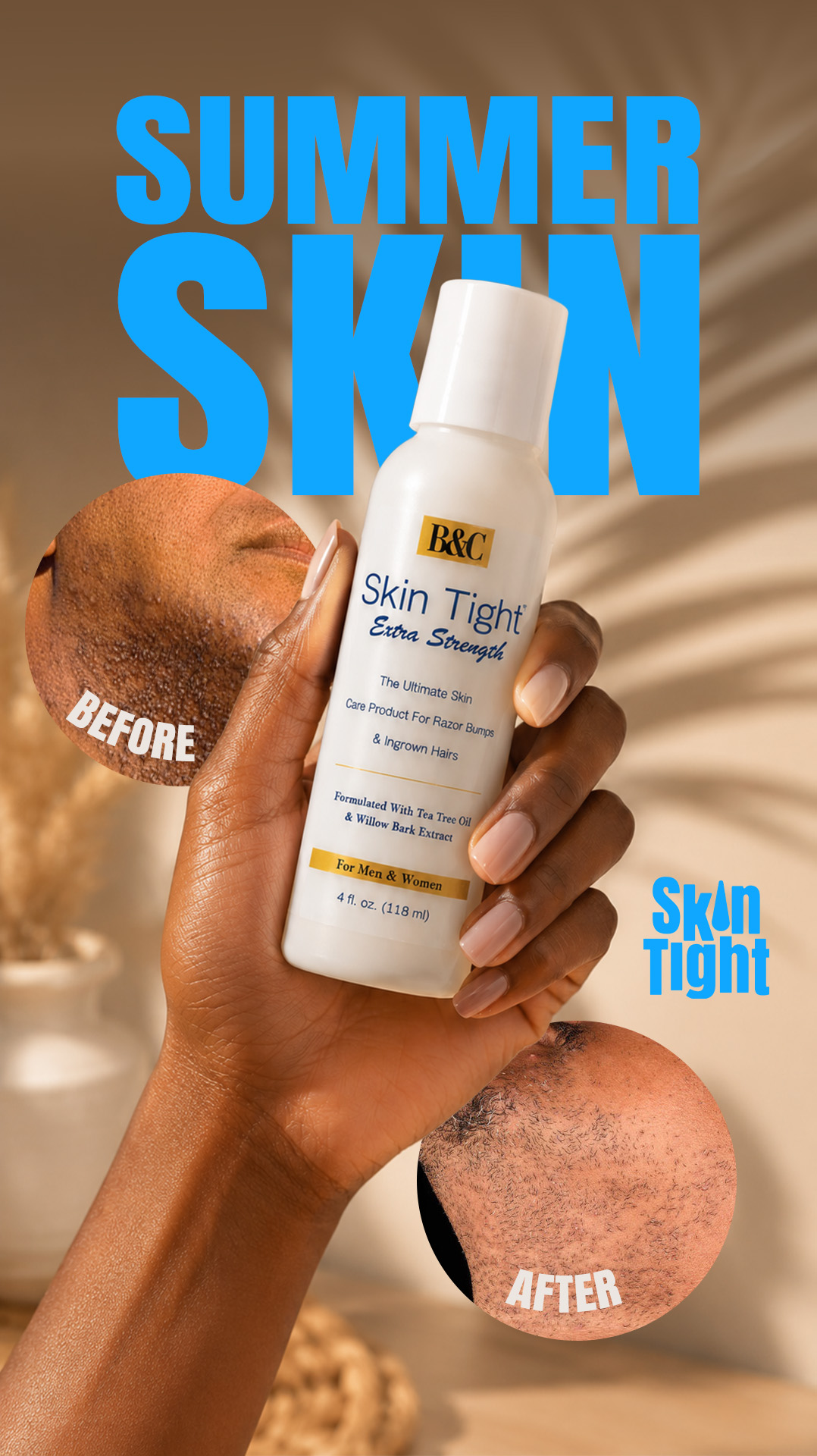 Skin Tight Facebook ad: Goodbye Razor Bumps. Hello Summer.