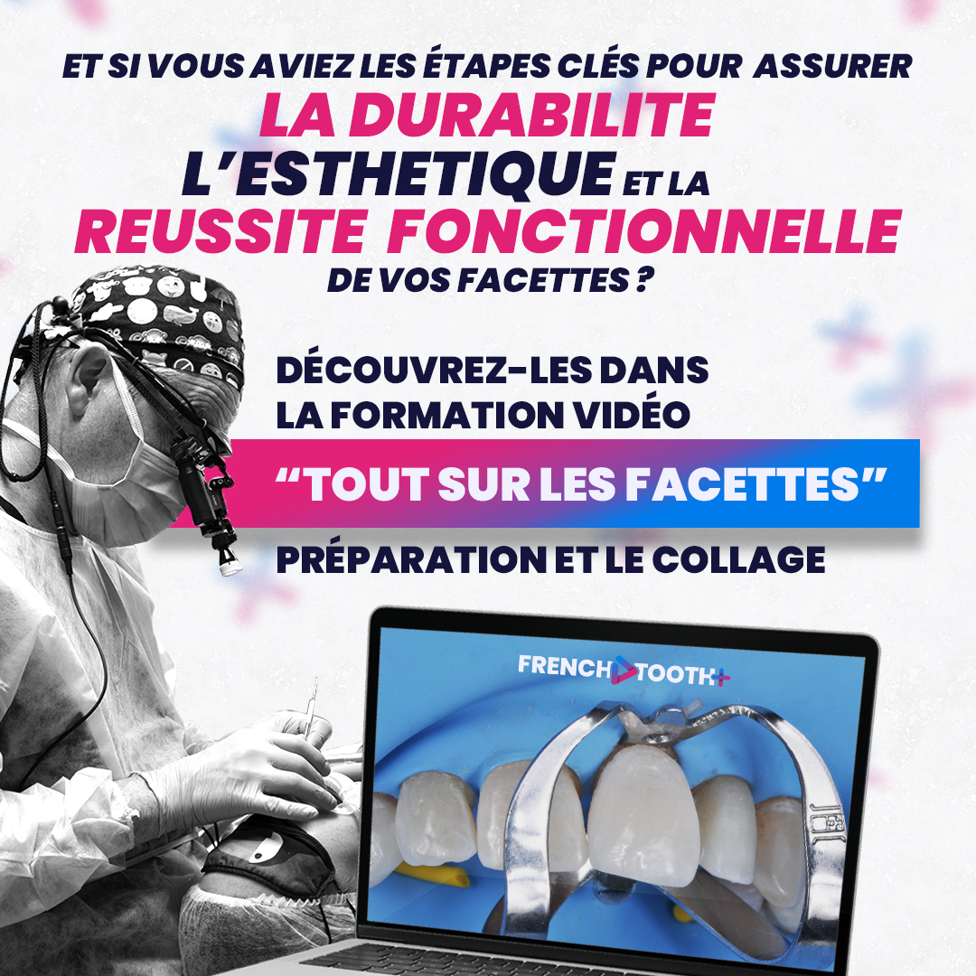 French Tooth Facebook ad