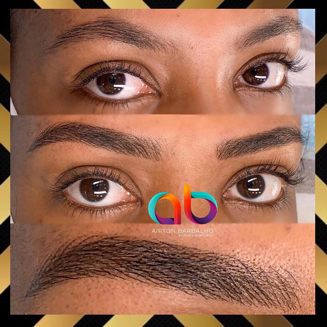 AB Estética Avanzada Facebook ad