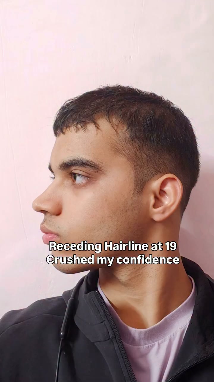 Hair Matters by Man Matters Facebook ad: No side effects | Clinically Tested