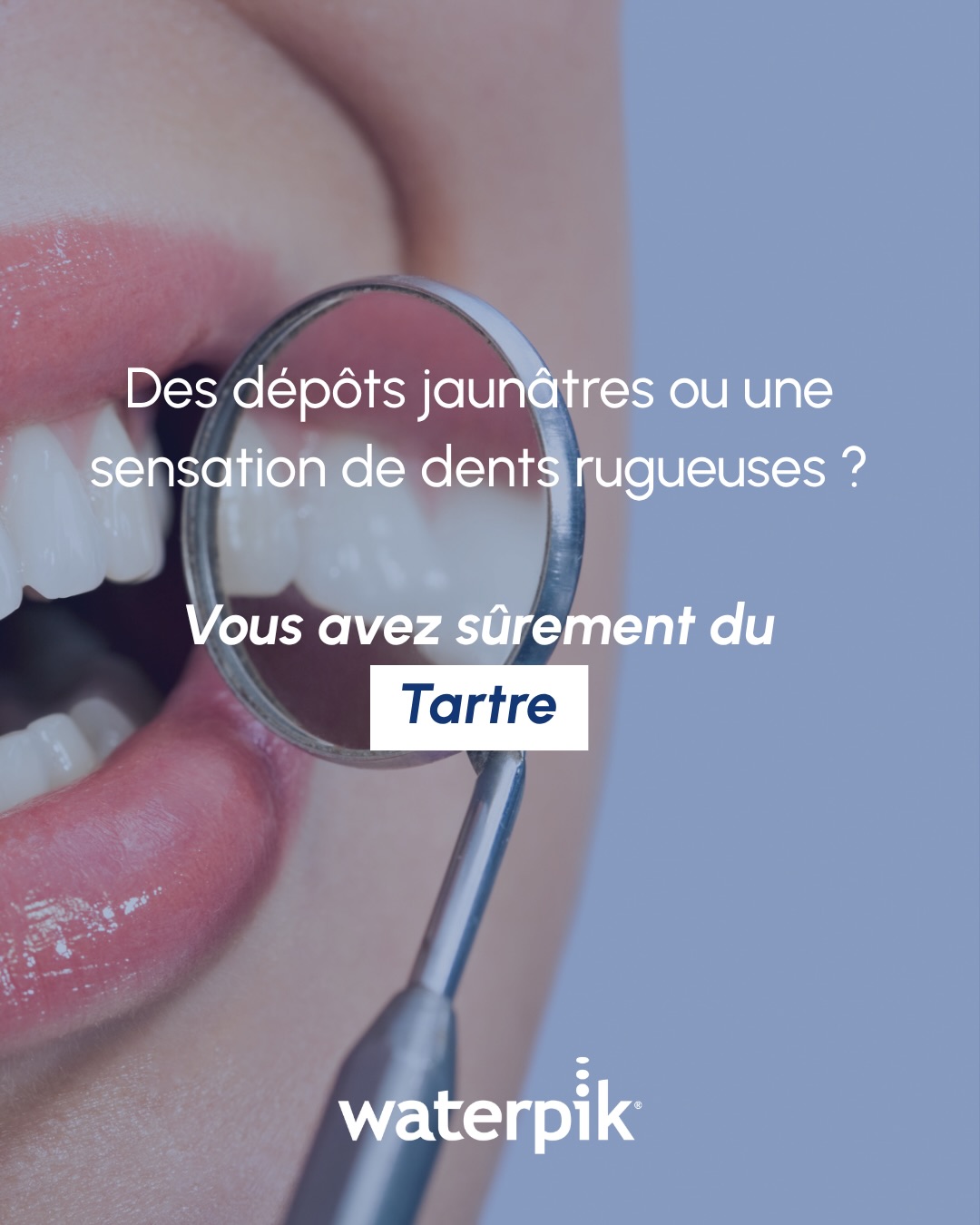Frame 55 Facebook ad: Une sensation de dents rugueuses?