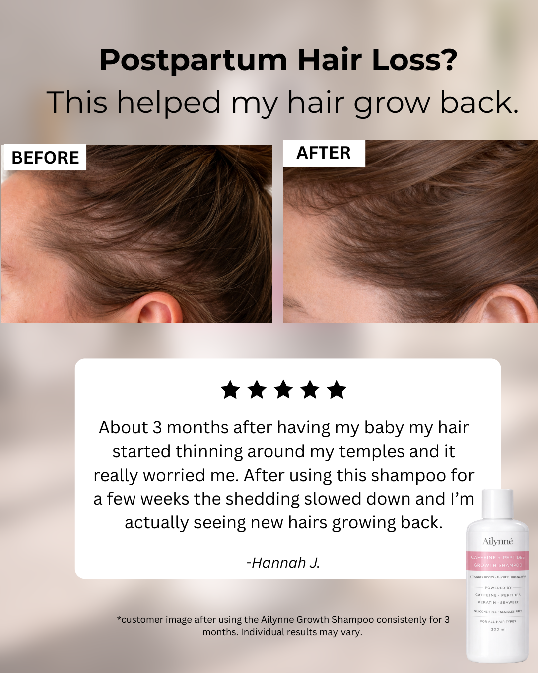 Ailynné Facebook ad: Get Your Hair Back After Pregnancy