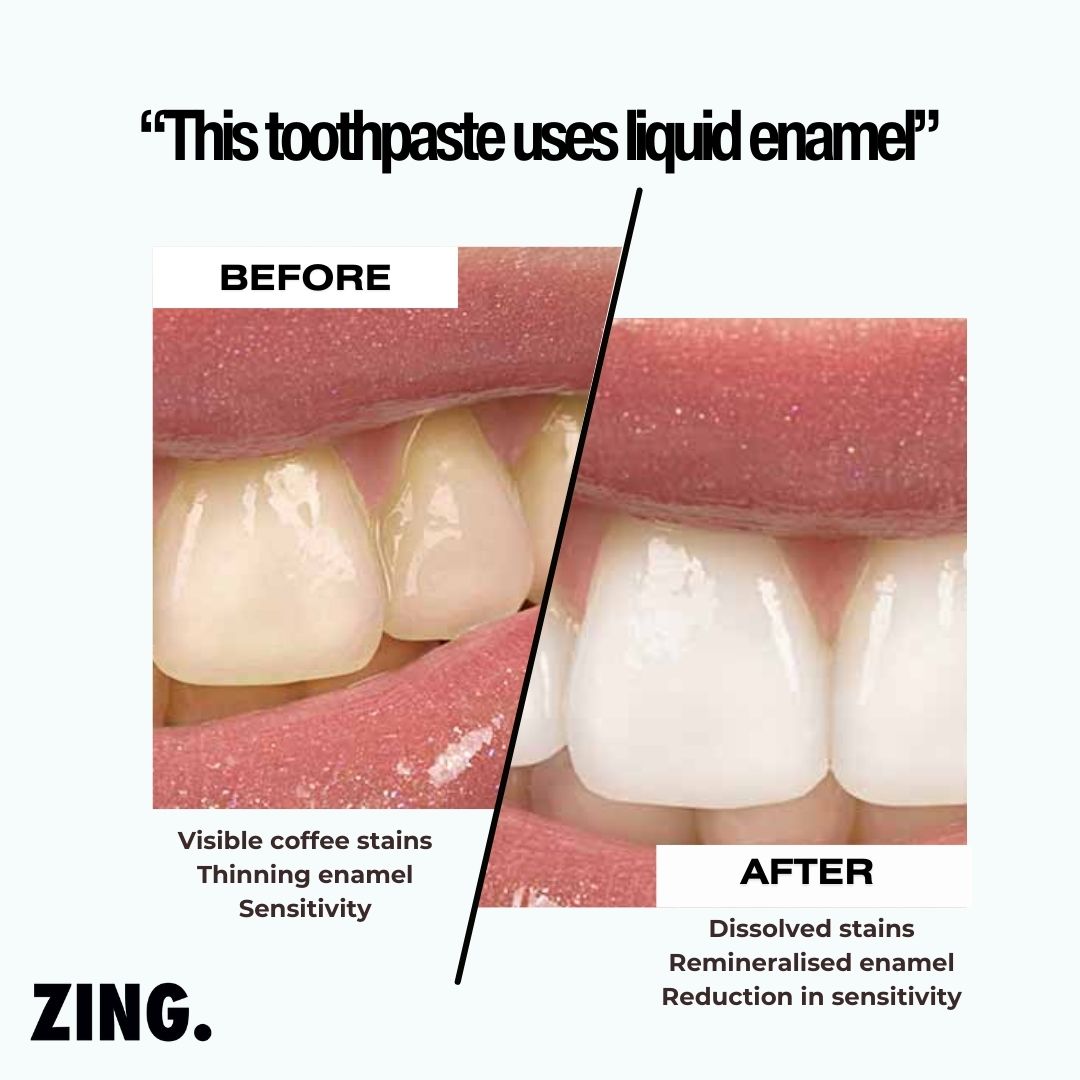 ZING. Toothpaste Facebook ad